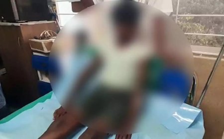 ചട്ടുകം പഴുപ്പിച്ച് 7 വയസുകാരന് പൊള്ളലേൽപ്പിച്ചു; അമ്മയെ ഇന്ന് അറസ്റ്റ് ചെയ്തേക്കും