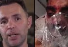 'Head and Arms Severely Injured': Israeli Dentist Recounts Saving Bloodied Indian Pilot