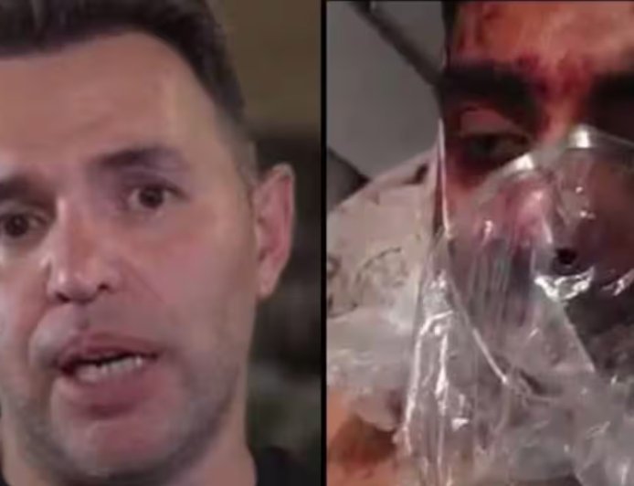 'Head and Arms Severely Injured': Israeli Dentist Recounts Saving Bloodied Indian Pilot